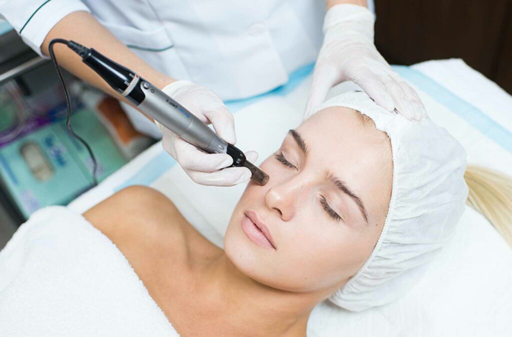 Tratamiento Dermapen